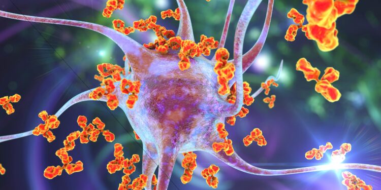 Grafische Darstellung einer Nervenzelle, die von körpereigenen Immunzellen angegriffen wird.