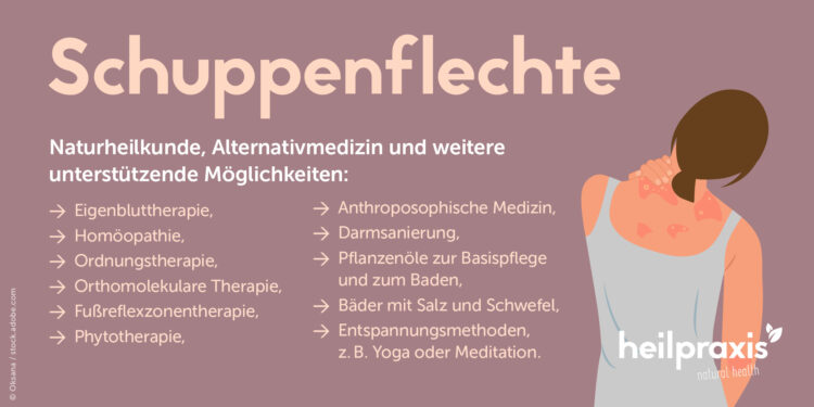 Übersicht begleitender Möglichkeiten der Alternativmedizin und Naturheilkunde bei Schuppenflechte