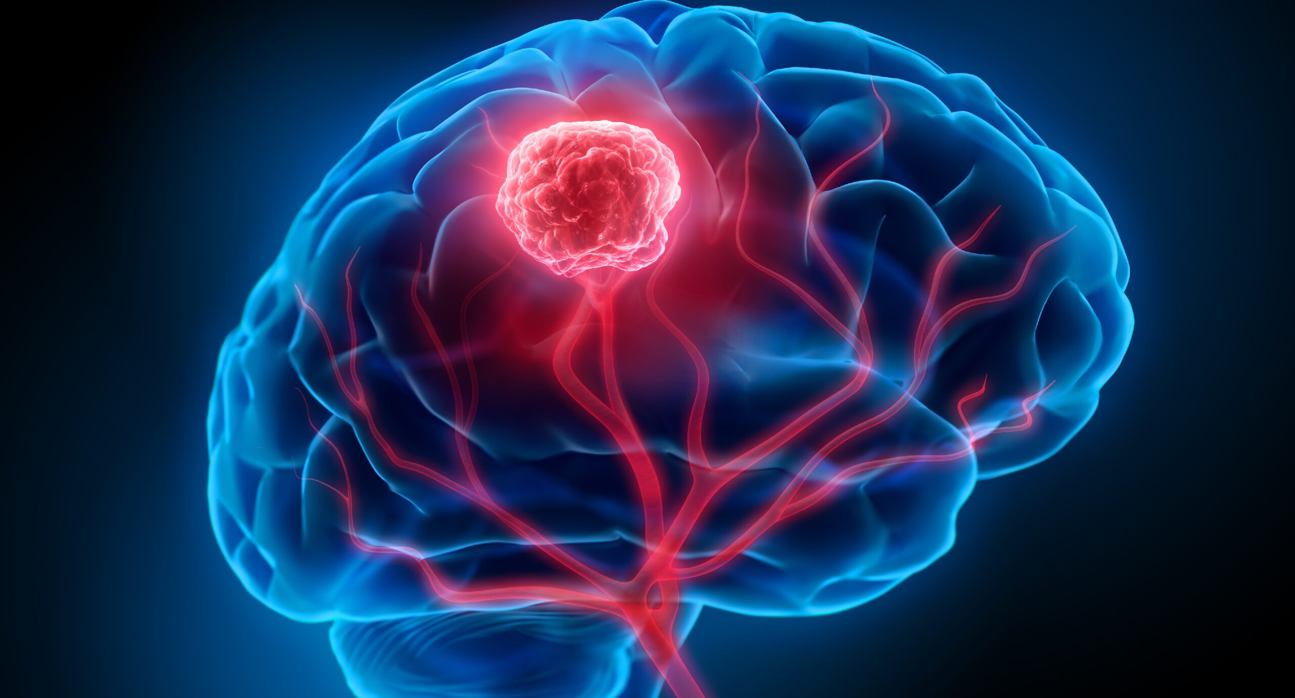 Krebs Code der TumorKommunikation geknackt Heilpraxis