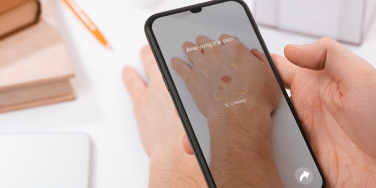 Eine Person macht mit dem Smartphone ein Foto von einem Leberfleck auf der Haut.