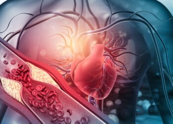 Grafische Darstellung eines Herzens und einer Arterie, die mit Plaques verstopft ist.