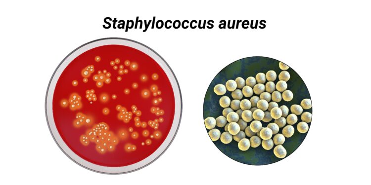 Grafische Darstellung von Staphylokokken-Bakterien.