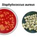 Grafische Darstellung von Staphylokokken-Bakterien.