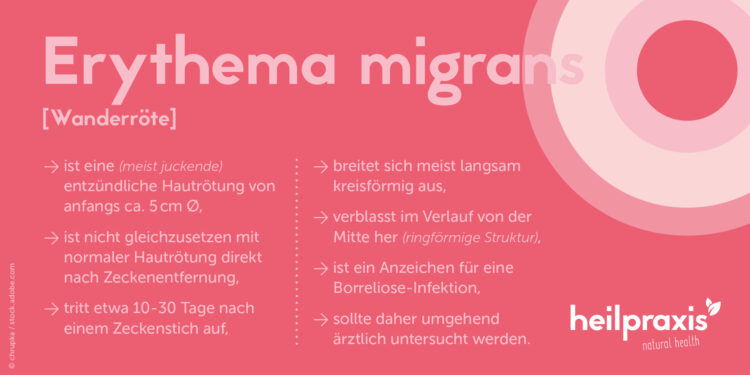 Übersicht wichtiger Merkmale von Erythema migrans oder Wanderröte nach einem Zeckenstich