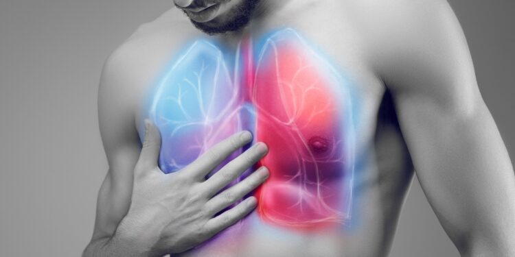 Auf dem Oberkörper eines Mannes sind die Lungen abgebildet.