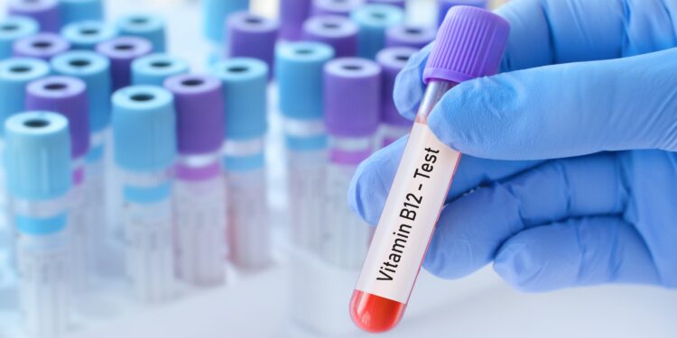 Laborglas mit Blut und der Beschriftung Vitamin-B12-Test