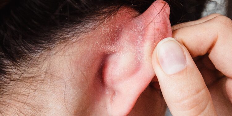 Hautregion hinter dem Ohr